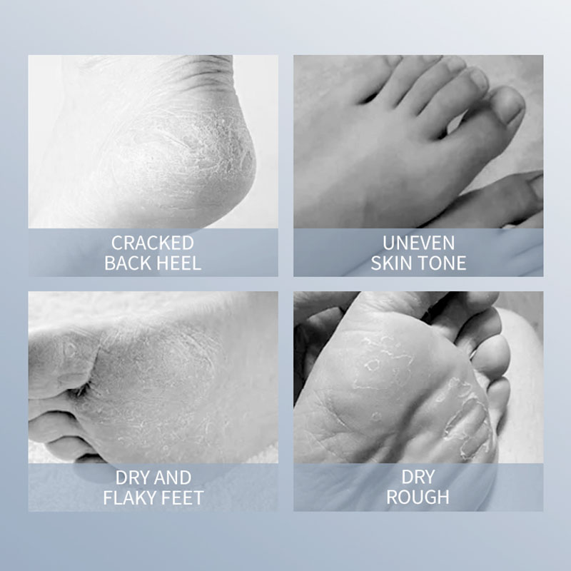 SADOER-mascarilla hidratante p - Foot Mask Peeling reseña y precio