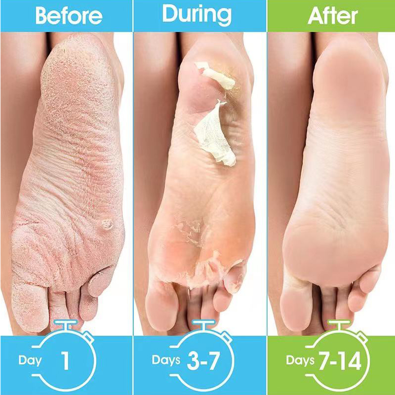 1 Pag=1 Par de Mascarillas de  - Foot Mask Peeling reseña y precio