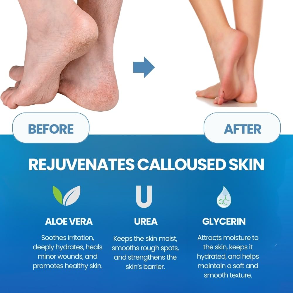 Exfoliante y Suavizante para P - Foot Mask Peeling reseña y precio