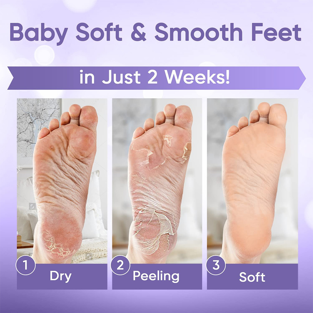 1-20 pares de mascarilla exfol - Foot Mask Peeling reseña y precio