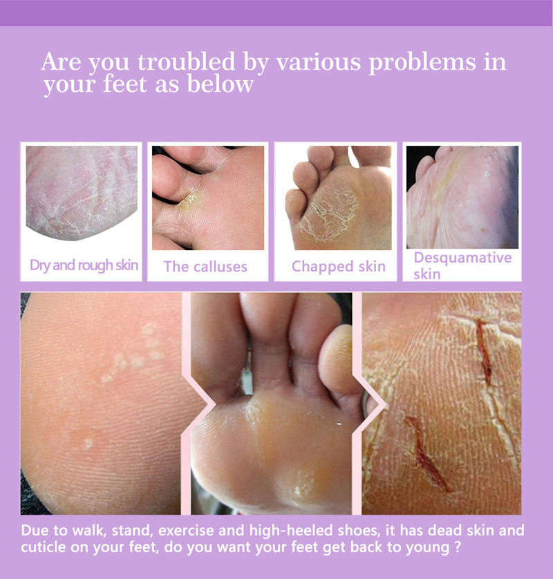 Mascarillas Exfoliantes para P - Foot Mask Peeling reseña y precio