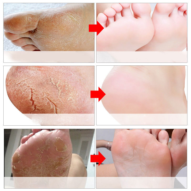 Mascarillas Exfoliantes para P - Foot Mask Peeling reseña y precio
